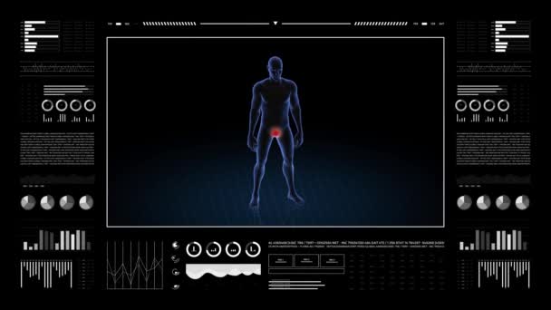有生殖器病理学的人3D身体的男孩 旋转动画和男性人体结构的特写 Hud镜头 — 图库视频影像