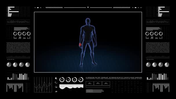 手の病理を持つ男 少年の3Dボディ アニメーションを回転させ 男性の人間構造の閉鎖 Hud映像 — ストック動画