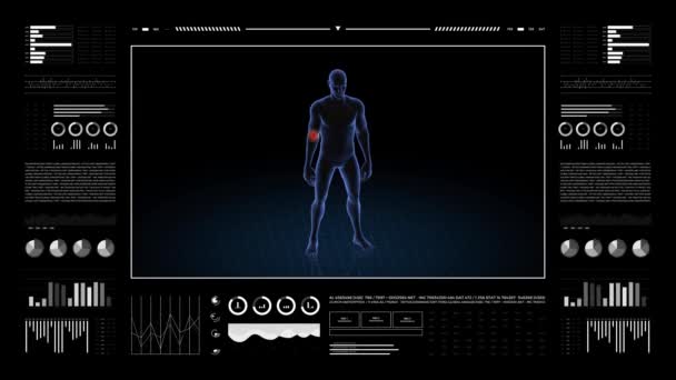 Dirsek Patolojisi Olan Adam Çocuğun Boyutlu Vücudu Dönen Animasyon Erkek — Stok video