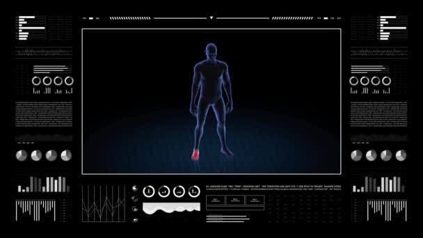 足の病理の男 少年の3Dボディ アニメーションを回転させ 男性の人間構造の閉鎖 Hud映像 — ストック動画