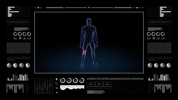 膝の病理の男 少年の3Dボディ アニメーションを回転させ 男性の人間構造の閉鎖 Hud映像 — ストック動画