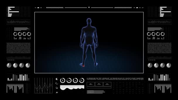 Człowiek Patologią Pięty Trójwymiarowy Chłopiec Obracająca Się Animacja Zbliżenie Męskiej — Wideo stockowe