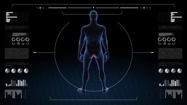 Homme Avec Une Pathologie Anus Corps Garçon Rotation Animation Gros — Video