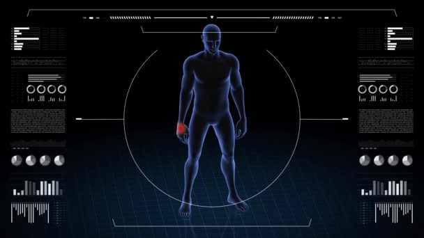 Patolojisi Olan Bir Adam Çocuğun Boyutlu Vücudu Dönen Animasyon Erkek — Stok video