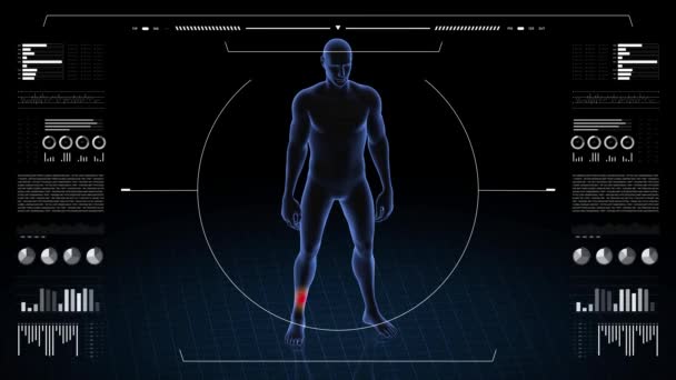 Man Ankle Pathology Body Boy Rotating Animation Closeup Male Human — Stock Video