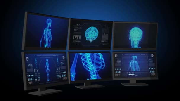 Medical Computers Workstation Animated Infographics Images — 图库视频影像