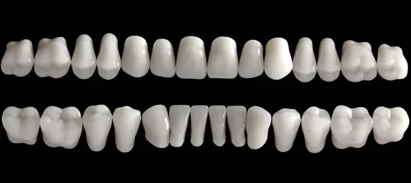 人間の歯の詳細を閉じる 黒の背景に歯のサンプル — ストック写真