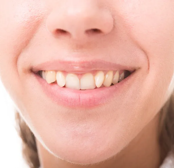 Broad smile — Stock Photo, Image