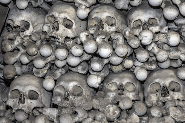 Human bones.