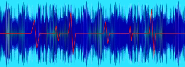 Línea roja Heratbeet en pantalla de electrocardiograma turquesa . — Foto de Stock