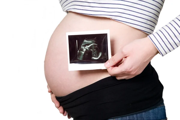 Pregnant woman hands holding ultrasound photo — Stock Photo, Image
