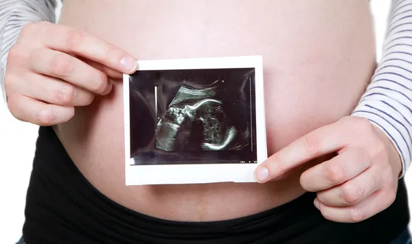 Pregnant woman holding ultrasound photo — Stock Photo, Image