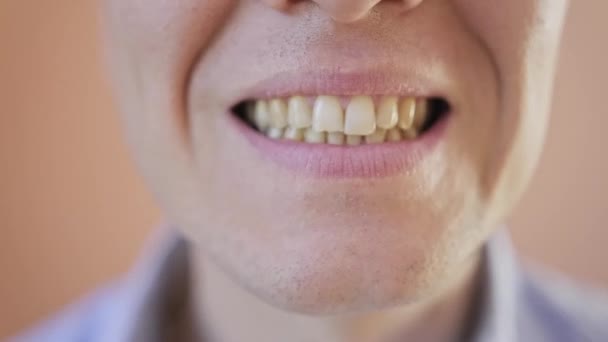 Bonito Homem Caucasiano Está Mostrando Seus Dentes Enquanto Abre Fecha — Vídeo de Stock