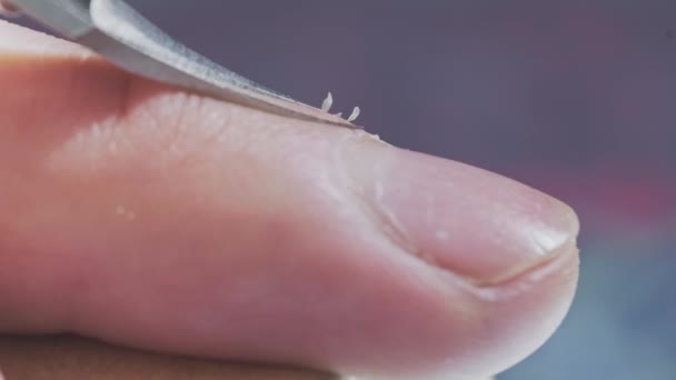 Makro Närbild Kaukasiskt Manligt Finger Med Torr Hud Processen Att — Stockvideo