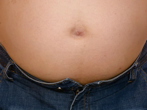 Sobrepeso hombrecito gordo sobre fondo blanco —  Fotos de Stock