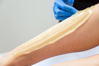 Profesyonel şekerci müşterinin bacağına balmumu sürüyor.