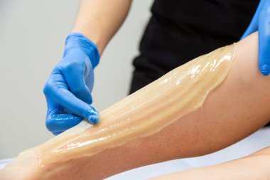 Profesyonel şekerci müşterinin bacağına balmumu sürüyor.