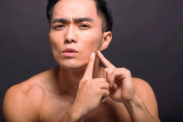 Handsome Young Man Touching His Face Squeezing Pimple — Fotografia de Stock