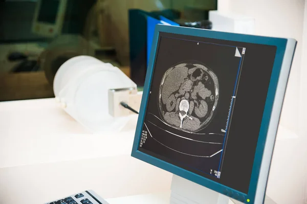 Laboratório Pesquisa Médica Tela Mostrando Resultados Ressonância Magnética Paciente — Fotografia de Stock