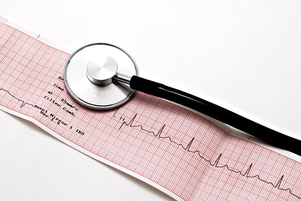 Stetoscopio con ECG — Foto Stock