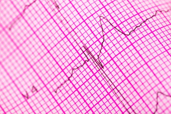 Граф кардиограммы — стоковое фото