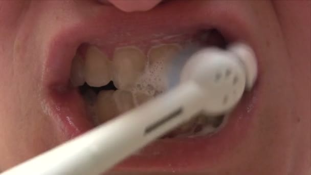 Higiene dentária — Vídeo de Stock