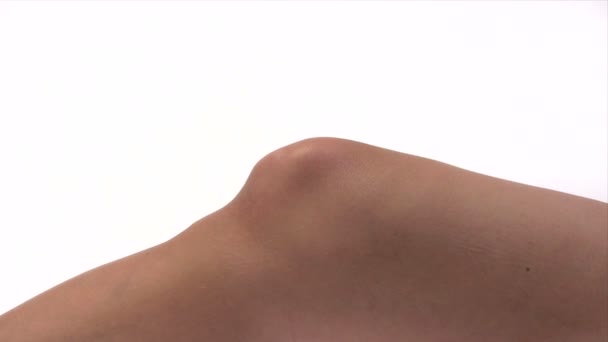 Травма колена — стоковое видео