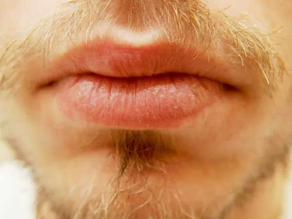 Droge mannelijke lippen — Stockfoto