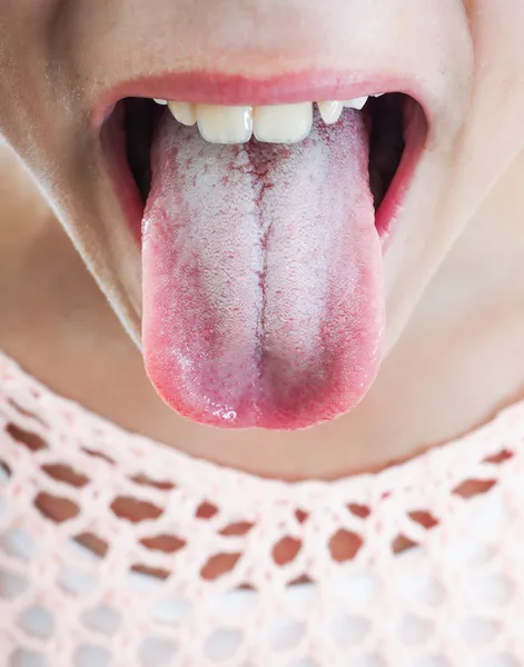 Protruding white tongue — Stock Photo, Image