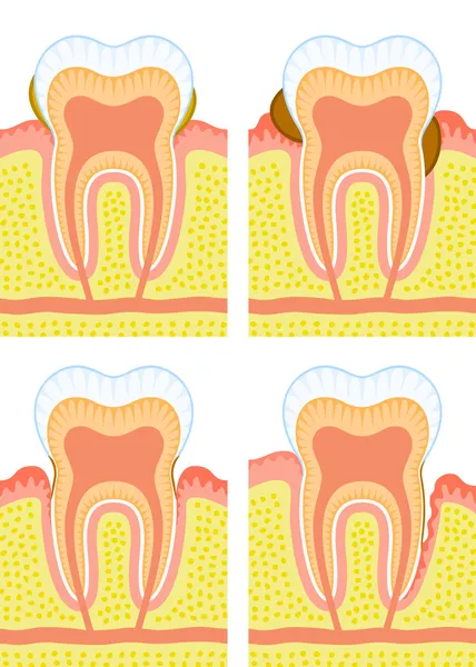 Interne structuur van tand — Stockvector