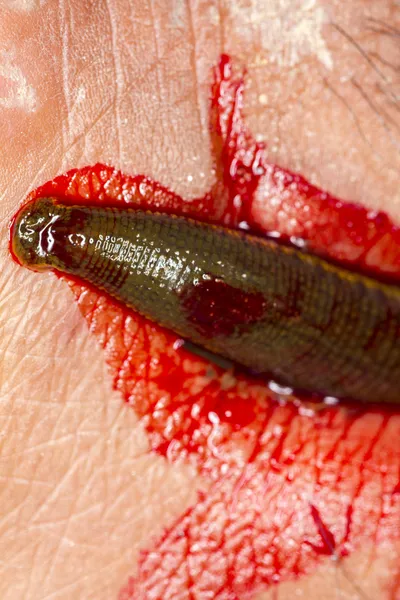leech blood leech blood