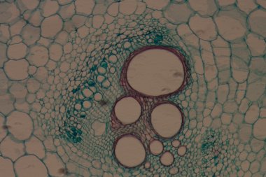 microscopy micrograph plant tissue, stem of pumpkin clipart
