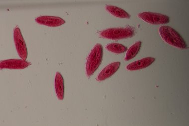 animal conjugación del paramecium caudatum