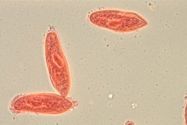 animal conjugación del paramecium caudatum