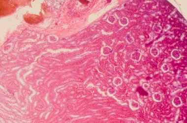 insan böbrek doku mikroskobik bölümde