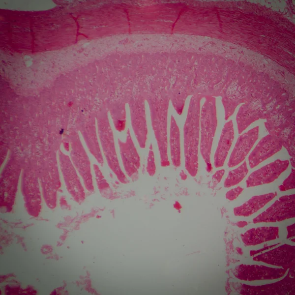 인간의 작은 intestinum tenue 조직의 미세한 섹션 — 스톡 사진