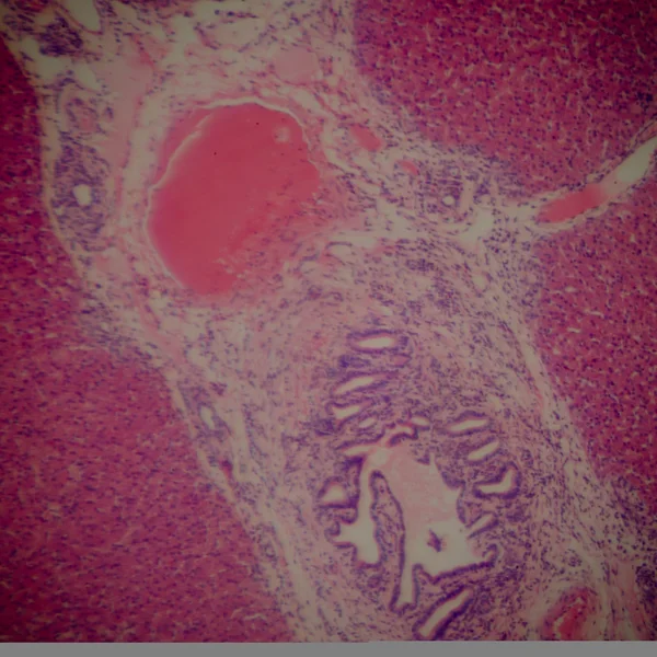 Sección microscópica del hígado humano —  Fotos de Stock