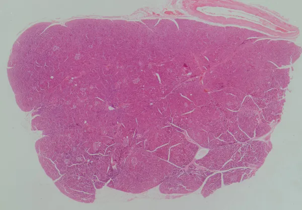 Sezione microscopica del pancreas umano — Foto Stock