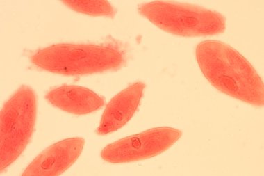 animal conjugación del paramecium caudatum
