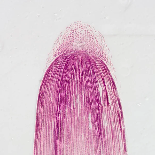 Mikrographie pflanzliche Wurzelspitzenzelle — Stockfoto