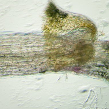 bitki arabidopsis thaliana kök dokusu mikro