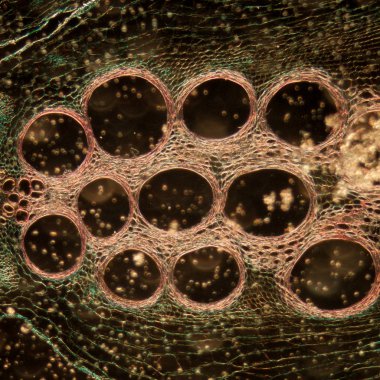 microscopy micrograph plant tissue, stem of pumpkin clipart