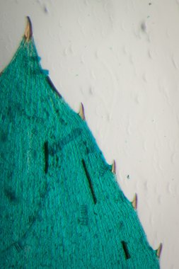 siyah alga yaprak mikro