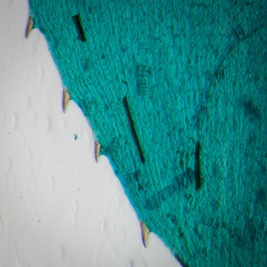 siyah alga yaprak mikro