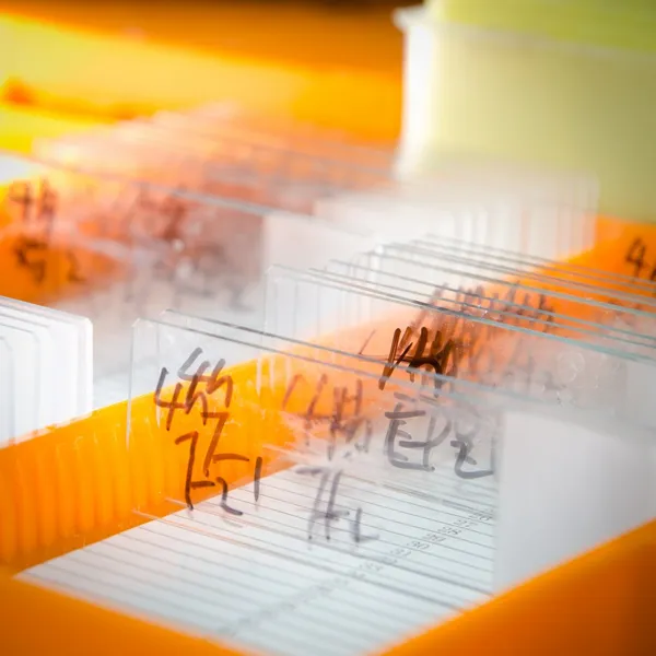 Glass microscope slide — Stock Photo, Image