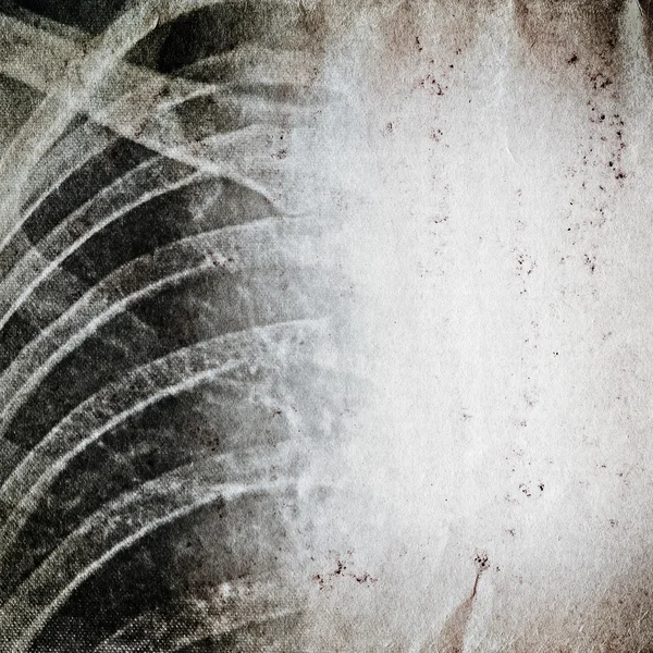 X-ray of human chest old grunge paper texture — Stock Photo, Image