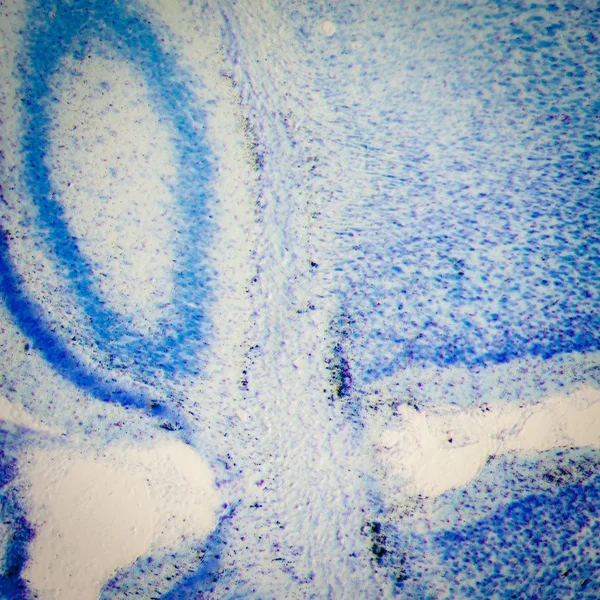 显微镜下大鼠脑海马神经元 — 图库照片