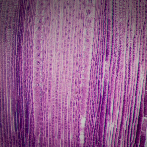 Mikrographie pflanzliche Wurzelspitzenzelle — Stockfoto