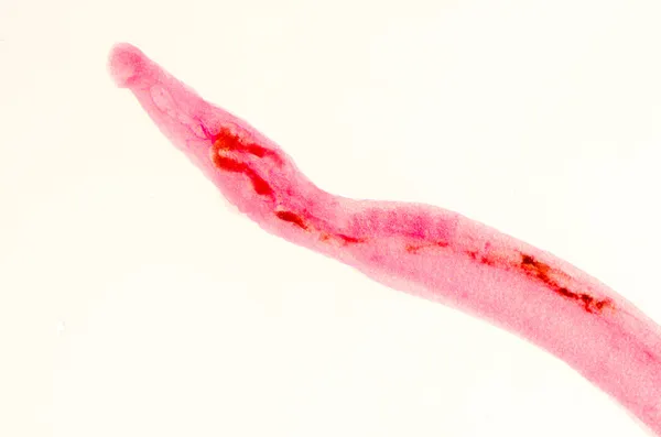 동물 parasiteras schistosome 혈액 마리가 — 스톡 사진