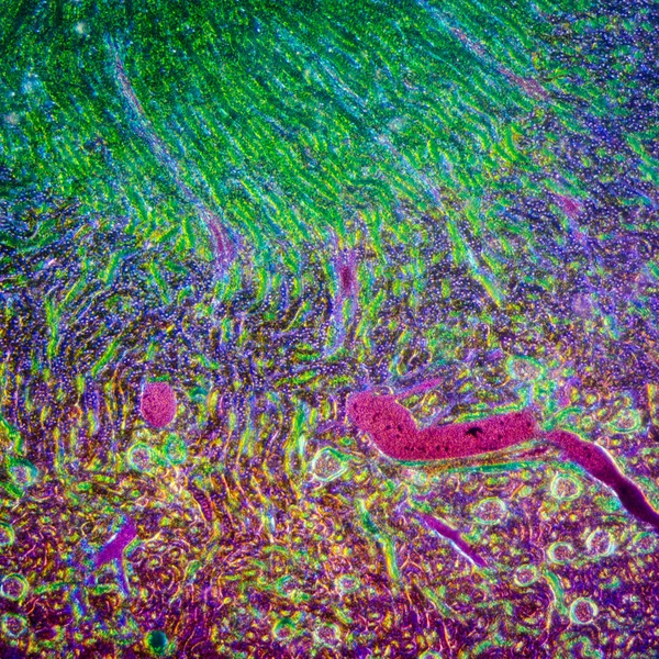 Μικροσκοπική ενότητα της ανθρώπινης νεφρικό ιστό — Φωτογραφία Αρχείου